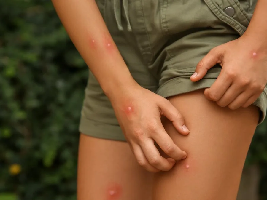 Piqures d'insectes